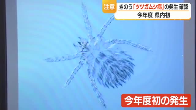 治療遅れると死に至るケースも　2026年初「ツツガムシ病」　田畑仕事で素肌露出しないで　山形 画像