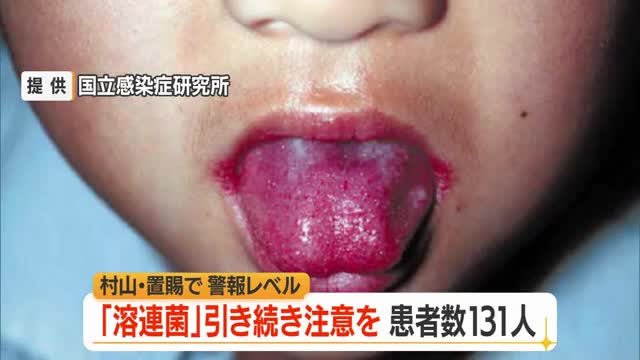 溶連菌131人（前週比+78人）　水ぼうそう注意報レベル　引き続き注意必要　山形 画像